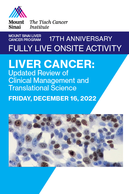 MOUNT SINAI LIVER CANCER PROGRAM. 17th ANNIVERSARY.  “LIVER CANCER: UPDATED REVIEW OF CLINICAL MANAGEMENT AND TRANSLATIONAL SCIENCE” Banner
